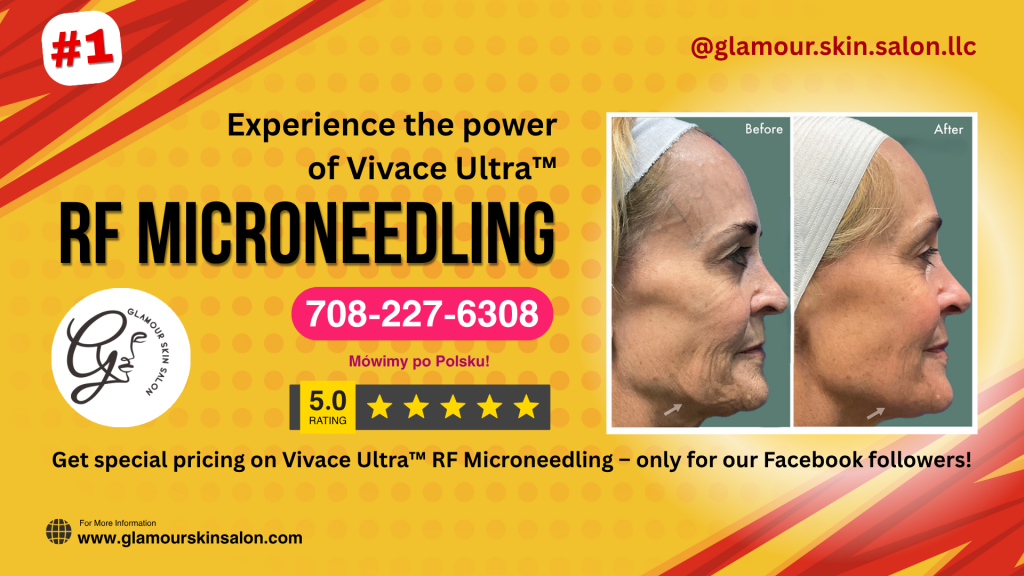 Vivace Ultra RF microneedling treatment at Glamour Skin Salon in Palos Heights, serving Worth, Orland Park, and Chicago suburbs